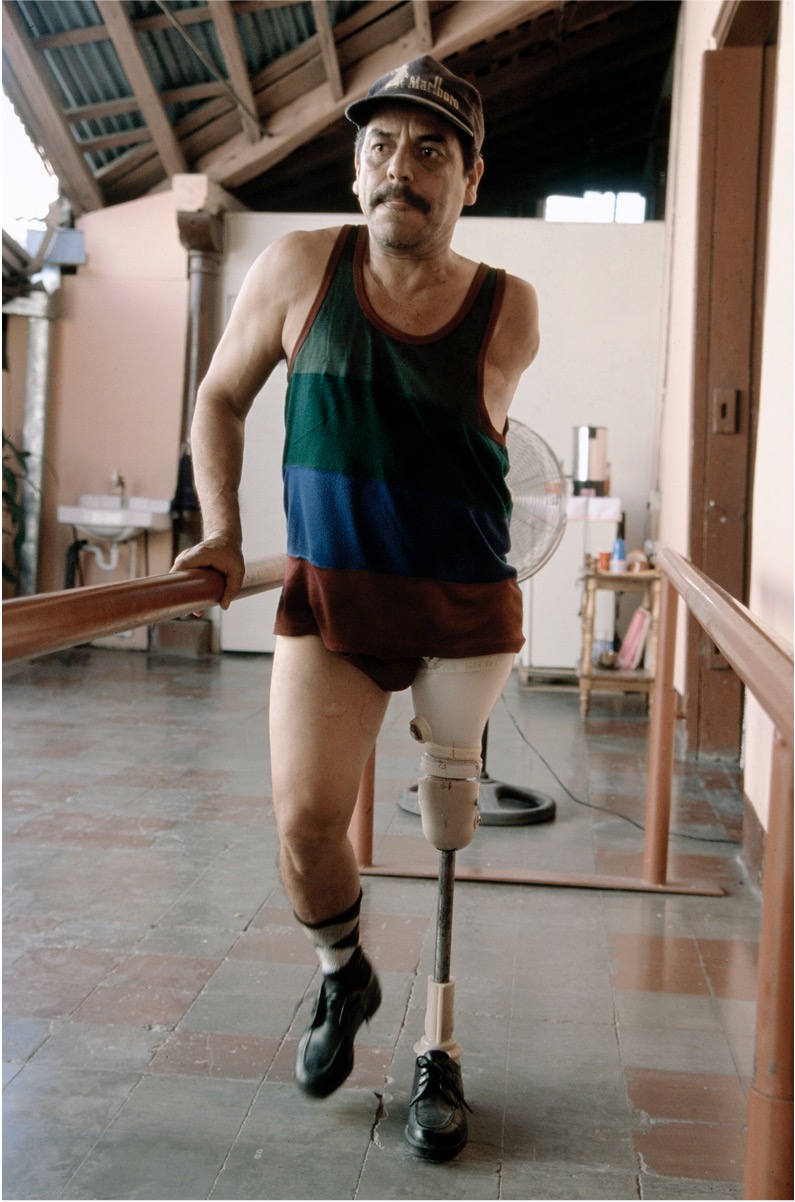 Man walking and trying out a new prosthetic leg at prosthetic clinic in Nicaragua (photo by Stephen Petegorsky)