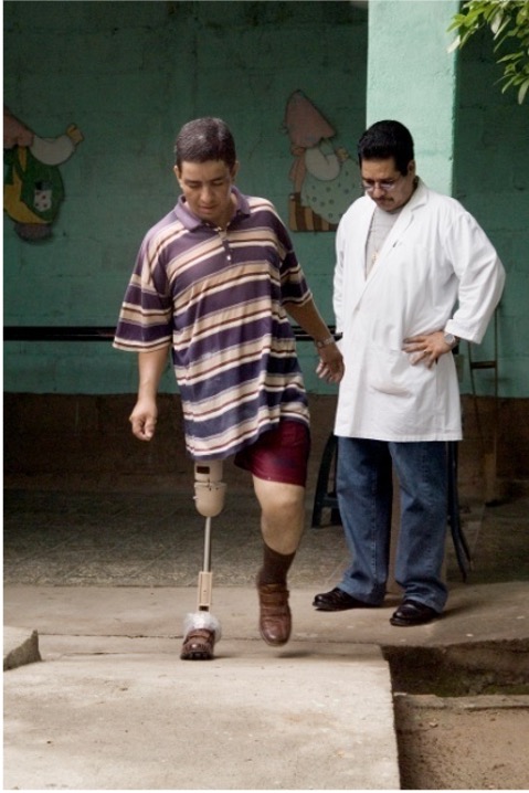 man with prosthetic leg walking while technician observes how the new limb works (photo by Stephen Petegorsky)